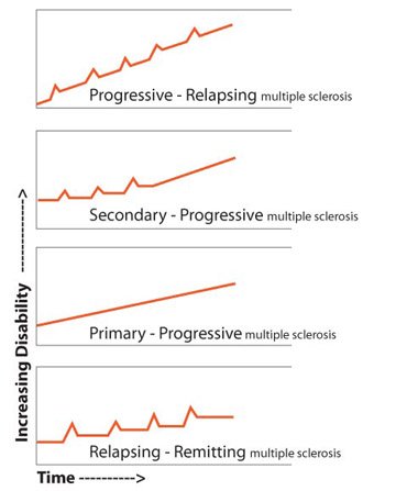 Progressive Relapsing Ms Progressive Relapsing Ms