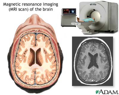 MRI - Magnetic Resonance Imaging
