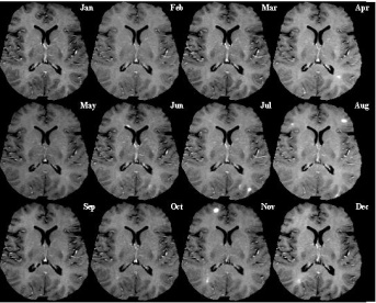 Monthly MRI Images