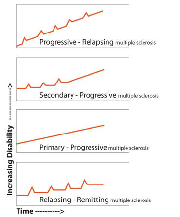 Types of MS Graphs