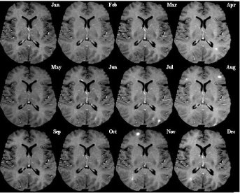 Monthly MRI Images