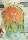 Brain Trust, solarplate etching based on the artist's MRI