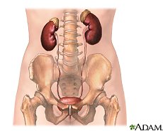bladder problems - urinary system